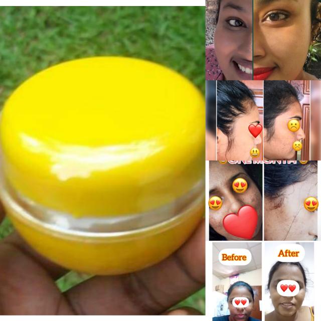 Shey beauty cream 
