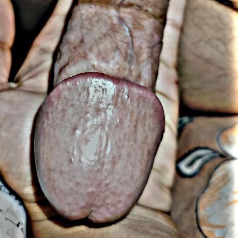 THE PENIS ?