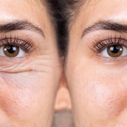 Anti aging natural herbal