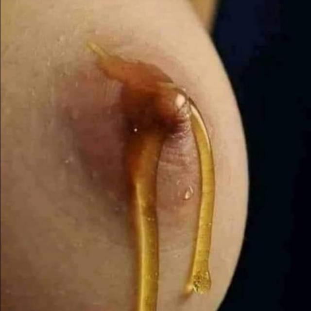നീലത്താമര?