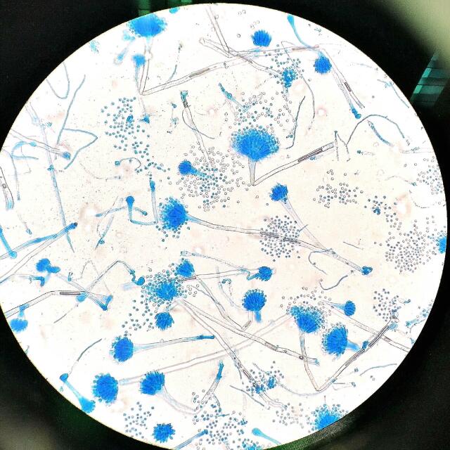 Microbiologist job career